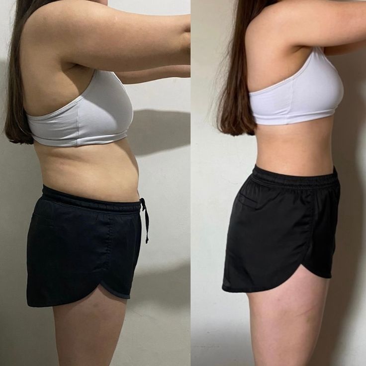 Gomitas de Fibra | Desinflama y suelta todo lo atascado