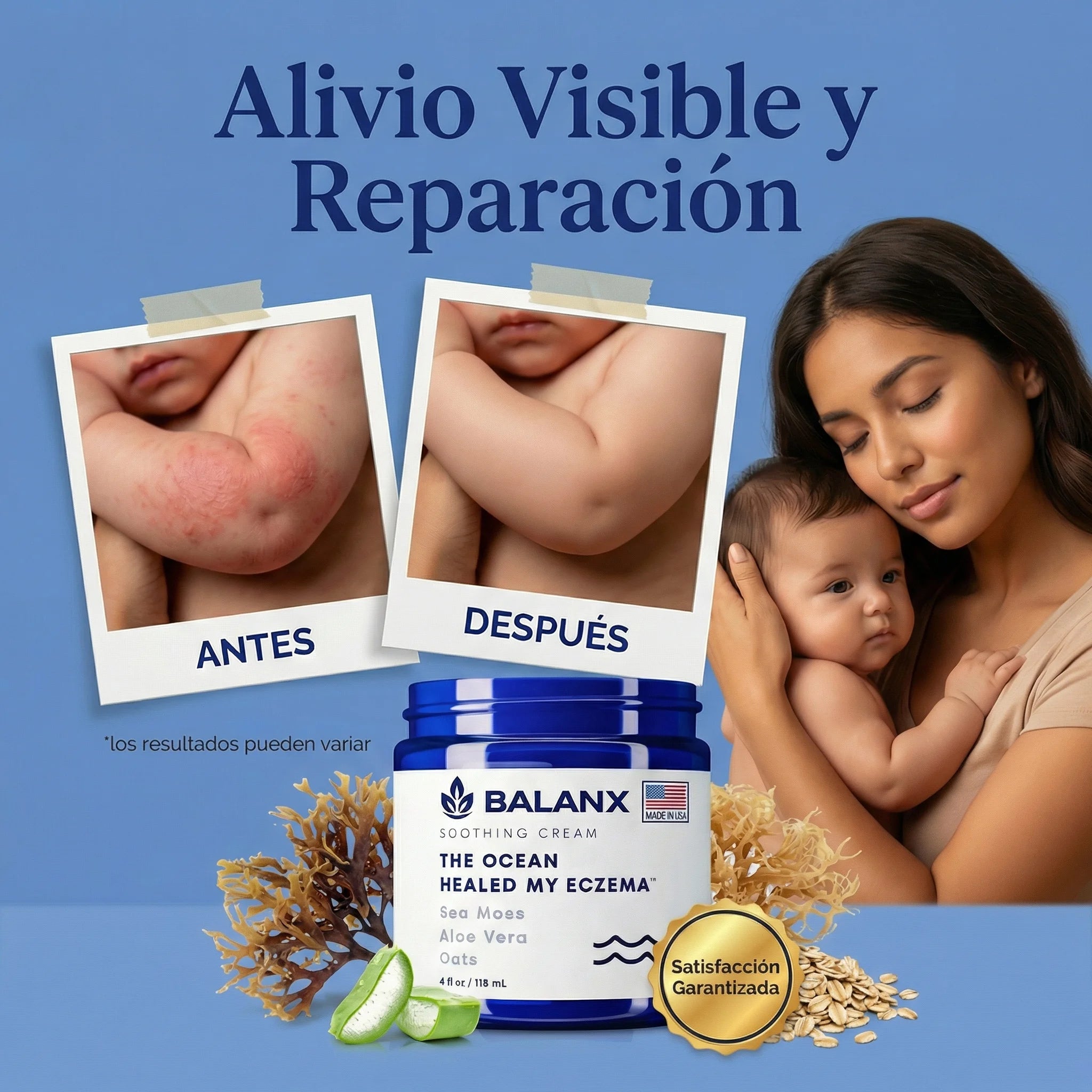 Crema Calmante para Eczema | Alivio sin Ardor, Desde el Primer Día
